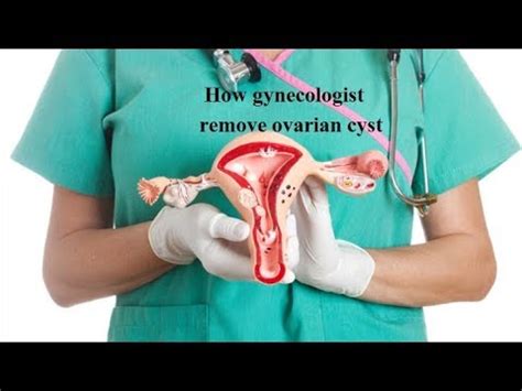what size ovarian cysts should be removed.